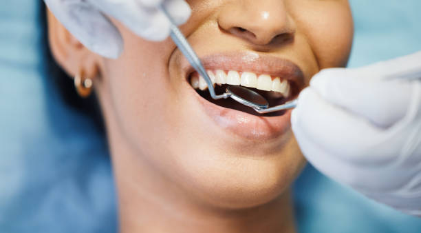 Best Emergency Dentist for Lost Fillings or Crowns in Pine Ridge, FL